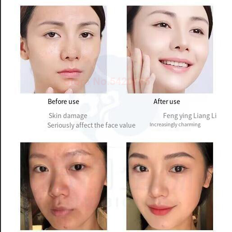 0.25 mm Microneedle GHK-Cu Blu - Licorice Root Extract review and price