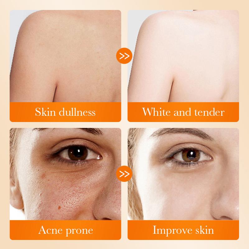 1Pc SADOER Kojic Acid Facial S - Kojic Acid Soap review and price