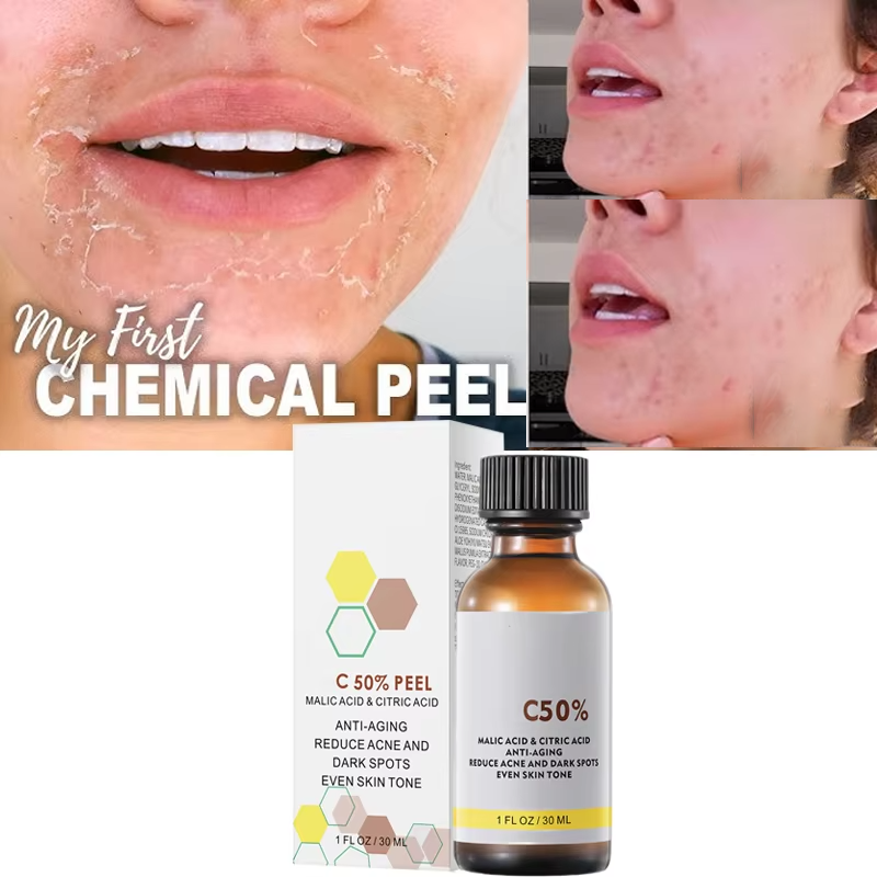 With Malic Acid And Citric Aci - Licorice Root Extract review and price
