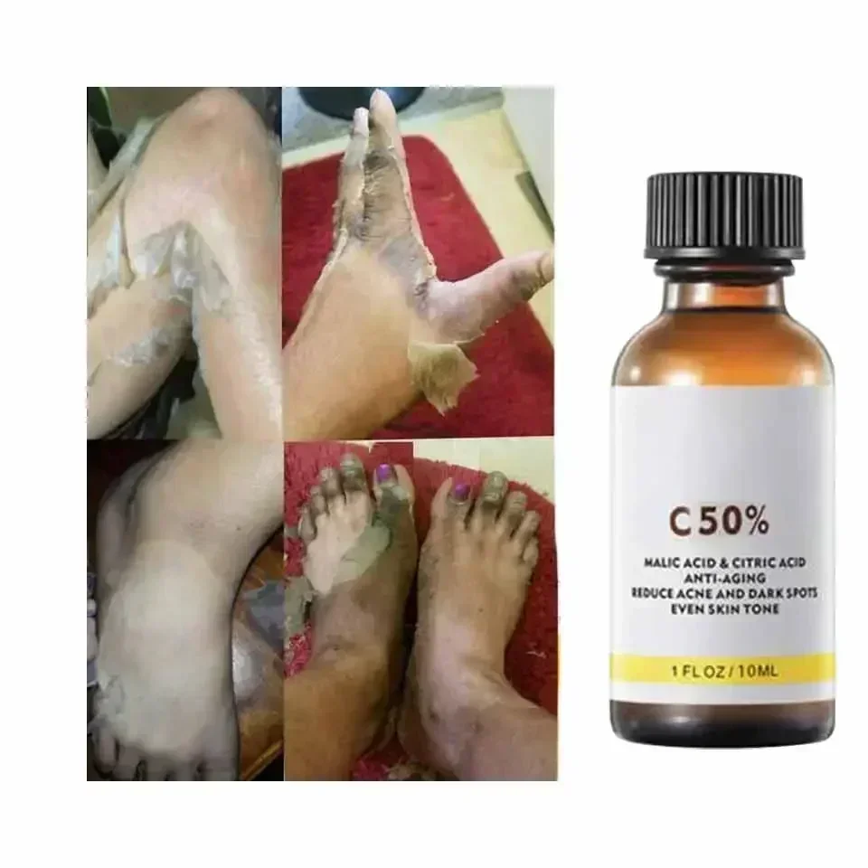 With Malic Acid And Citric Aci - Licorice Root Extract review and price